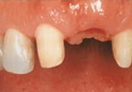 fot. Przed leczeniem