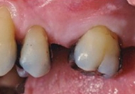 fot. Przed leczeniem